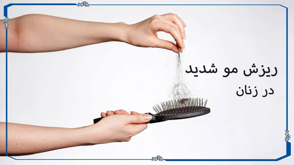 ترفندهایی برای درمان ریزش مو شدید در زنان