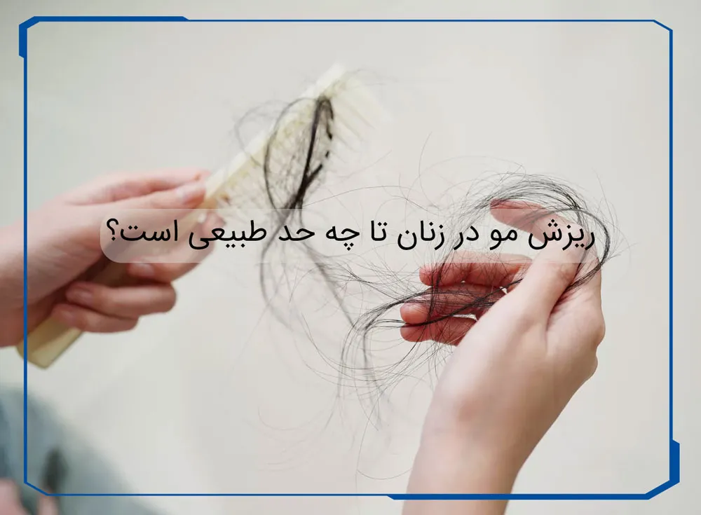 ریزش مو در زنان تا چه حد طبیعی است