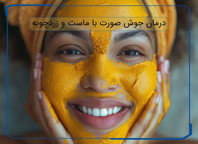درمان جوش صورت با ماست و زردچوبه