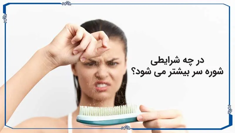 در چه شرایطی شوره سر بیشتر می شود