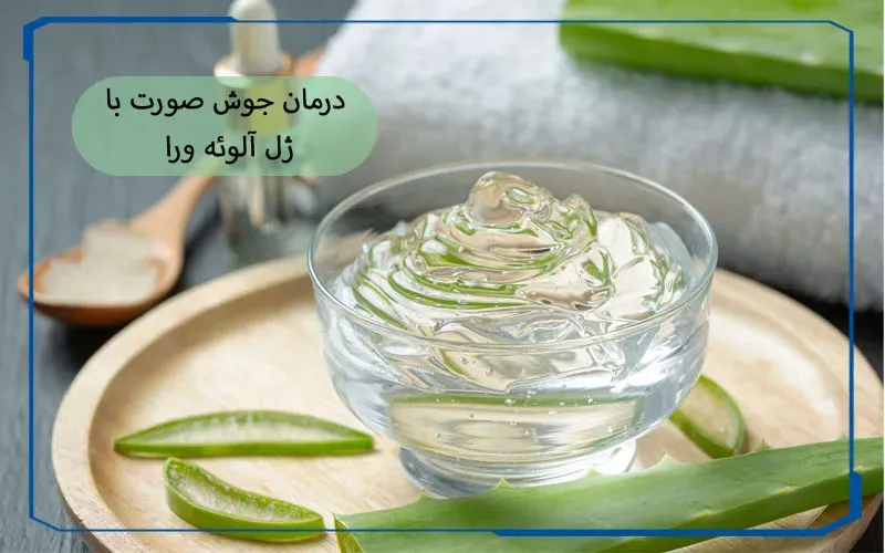 درمان جوش صورت با ژل آلوئه ورا