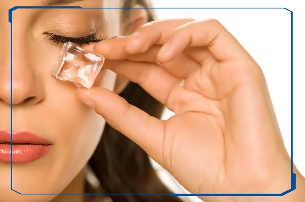 کمپرس یخ برای رفع پف زیر چشم