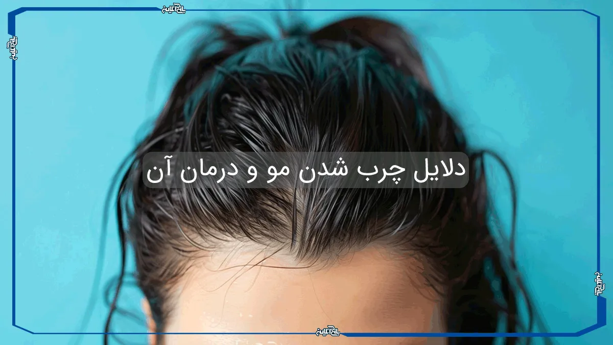 دلایل چرب شدن مو و درمان های خانگی آن