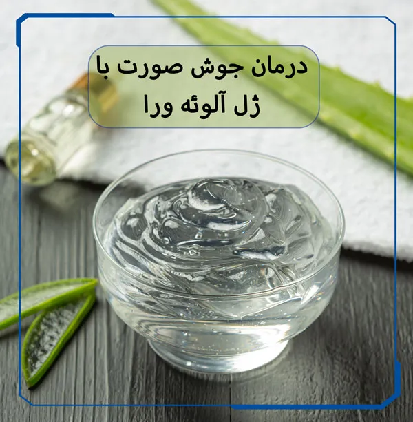 درمان جوش صورت با آلوئه ورا