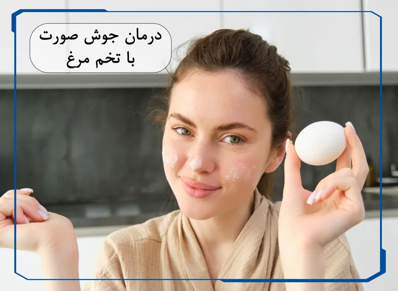 درمان جوش صورت با تخم مرغ