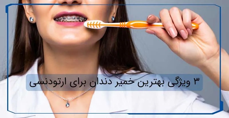 ویژگی بهترین خمیر دندان ارتودنسی