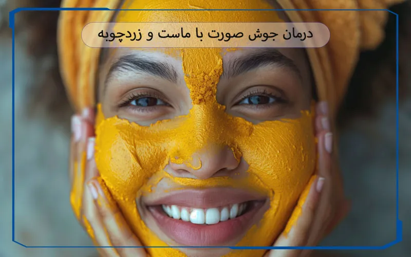 درمان جوش صورت با زردچوبه