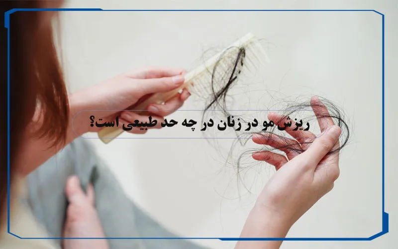ریزش مو در زنان